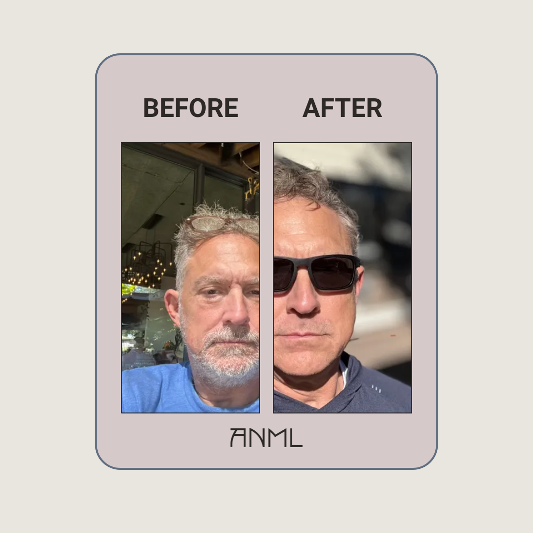 Before and after photo comparison panel for AMNL whipped tallow balm