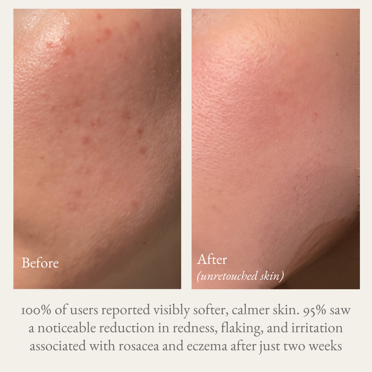 Goat milk hand & body lotion before-and-after skin results